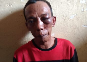 Yanto (39) Salah Satu Pelaku Curas Usai Dihajar Massa