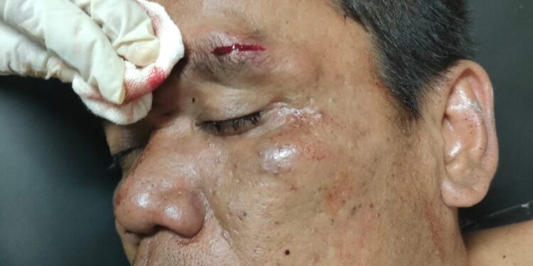 Terduga Maling Babak Belur dikeroyok masa di Segog Sukabumi